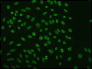 Indirect immunofluorescence for anti-NuMA 1: staining of nuclear granules and mitotic spindle fibers. Image courtesy of Dr. Eiras (Department of Immunology of the University Hospital Complex of Santiago de Compostela).
