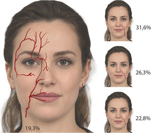 Facial arteries.