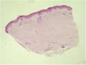 Hematoxylin–eosin staining, original magnification ×100.
