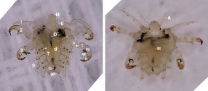 Pthirus pubis. Anatomic structure. Left, dorsal view. M: mouth. Formed by teeth (which cut into the epidermis like a circular saw) and a haustellum to suck the blood from the dermal vessels. The haustellum, in turn, contains 2 dorsal stylets (firmly positioned to form a conduit that empties into the pharynx), a medial stylet (containing a salivary canal), and a ventral stylet (that groups together the other stylets to form a fascicle). It also has distal teeth, which help penetrate the dermis. E: eye. 1: first leg (less robust than the other legs; fine terminal claw). D: digestive tube (seen against the light). Note the ingested blood. 2 and 3: second and third legs (more robust than the first leg; terminal claw similar to that seen in crabs, designed to grasp tightly to the hair of the host). Parts of the leg (c: coxa, tr: trochanter, f: femur, tb: tibia, tp: tibial projection; n: nail). D: dorsum showing some hair structures on the surface. *: spiracle. Phthirus pubis usually has 2 pairs of thoracic spiracles and 6 pairs of abdominal spiracles that connect the respiratory system to the outside. T: tracheal system. S: marginal septae. G: genital plate. gp: gonopod. Both the genital plate and the 2 gonopods are found in female specimens. Right image: ventral view. A: antenna (divided into 5 segments). Used to detect smell and moisture. St: sternite (segments constituting the ventral side).