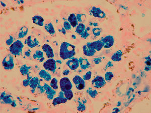 Perl's stain which shows the haemosiderin granules in blue inside the macrophages.