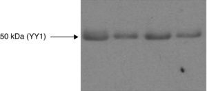 Western blot analysis for YY1 from the quadriceps muscle of COPD patients and healthy control subjects. Immunoblotting representative of YY1 in muscle samples of a control subject (left) and three COPD patients (right), subjected to immunoprecipitation using an anti-YY1 antibody. The bands are observed in position 50kDa. Statistically significant differences in the YY1 protein levels were not identified in the muscle of the patients compared with the control individuals.