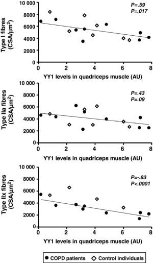 Point diagrams of the YY1 protein levels and CSA of the type I, IIa y IIx fibres in the quadriceps of patients with COPD and healthy control subjects. There were negative correlations between the YY1 protein levels and the CSA of the type I and IIx fibres and a tendency towards a negative correlation between the levels of the factor and the CSA of the type IIa fibres when the patients and the control subjects were combined (ρ=−0.83, P<.0001; ρ=−0.59, P=.017 and ρ=−0.43, P=.09, respectively), and a negative correlation between the levels of YY1 and the CSA of the type IIx fibres was only detected in patients (ρ=−0.88, P=0.002).