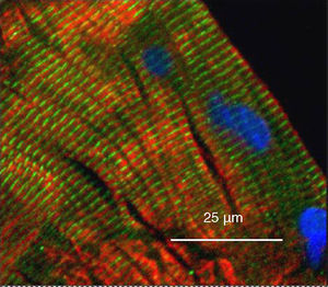 Image from a wide-field microscope of a longitudinal slice of the quadriceps muscle of a healthy control subject demonstrating the localisation of YY1 regarding the muscle nuclei by means of immunohistochemistry. The muscle was stained for YY1 (green), the heavy chain of the fast myosin (red) and the nuclei using 4′,6-diamidino-2-phenylindole (blue). The YY1 staining is observed along the sarcomeres, not co-localised with the myosin, and the absence of nuclei is also observed. (For interpretation of the references to color in this figure legend, the reader is referred to the web version of the article.)
