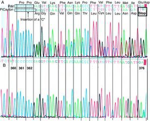 Direct sequencing of a V exon fragment from the α1-AT gene in the region corresponding to the allele PI Clayton. PI Clayton is a null variant of α1-AT characterized by the insertion of a cytosine in the V exon of the normal M1 allelic sequence (Val213) that usually has seven cytosines (C) that codify the amino acids 360–362. (A) Sequencing corresponding with the index case, heterozygous for the PI Clayton variant. In the upper part of the figure, the two overlapping sequences are indicated: PI M (non-mutated sequence) with seven cytosines and PI Clayton with eight cytosines. (B) Reference sequencing of the same fragment from a patient without the mutation.