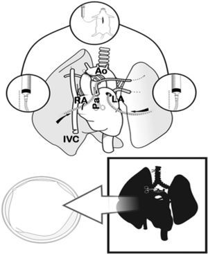 Clamping of the thoracic aorta (Ao) and transection of the left auricle (LA), right auricle (RA) and the inferior vena cava (IVC). Transection of the pulmonary artery (Pa) and anterograde perfusion. Afterwards, retrograde perfusion through the left pulmonary vein and auricle, and finally tracheal ligature with lungs semi-inflated and cardiopulmonary extraction.