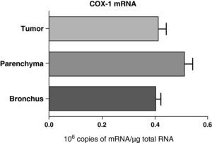 COX-1 mRNA expression in the tumor, lung parenchyma and bronchi of COPD patients with bronchial cancer (n=44). The means are represented with the standard deviations from the mean. The expression of mRNA is shown as the number of molecules compared with total RNA. There were no statistically significant differences.