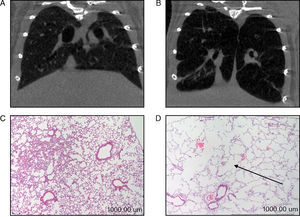 (A) Computerized axial tomography of control mouse lung. (B) Computerized axial tomography of lung of mouse treated with elastase. (C) Haematoxylin and eosin stain of control mouse lung. (D) Haematoxylin and eosin stain of lung of mouse treated with elastase. The arrow indicates an area of lung parenchyma in which increased interalveolar space is appreciated.