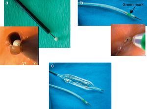 Instruments: (a) isolated-tip knife; (b) electrosurgical scalpel or endobronchial scalpel; (c) dilation balloon.
