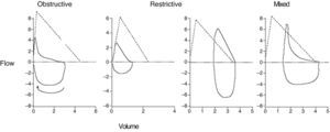Morphology of the flow–volume curve in the different respiratory function patterns.
