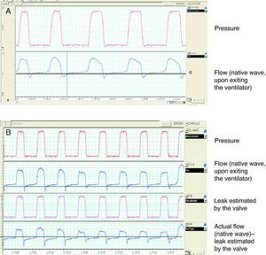 Presentation of native flow–time and pressure waves in a single-tube system with a controlled leak valve and support pressure mode. Note that in (A) the inspiratory flow is much greater than expiratory flow, with regard to point 0. In (B), the native wave has been corrected, subtracting the calculated leak flow.