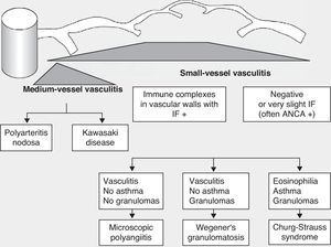 Classification of vasculitides. ANCA: anti-neutrophil cytoplasmic antibodies; IF: immunofluorescence (taken from Gómez-Román3).