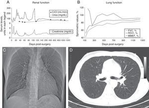 Renal and lung function follow-up data after the double transplant.