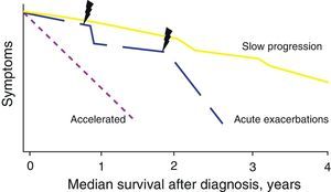 Natural history of idiopathic pulmonary fibrosis.
