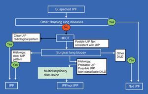 Diagnostic algorithm for idiopathic pulmonary fibrosis. For abbreviations, see text.