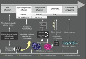 Outline of the pathogenesis of parapneumonic pleural effusion. IL-8, interleukin-8; TNFα, tumor necrosis factor; PAI, plasminogen activator inhibitor, t-PA, tissue plasminogen activator.