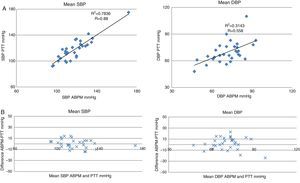 Linear correlation and concordance of PTT and ABPM. ABPM: ambulatory blood pressure monitoring; SBP: systolic blood pressure; DBP: diastolic blood pressure; PTT: pulse transit time. (A) Linear correlation between blood pressure measurements performed by PTT and by ABPM. The X-axis represents measurements by ABPM and the Y-axis represents measurement by PTT. (B) Bland–Altman concordance plot. The X-axis represents the mean blood pressure measured by both techniques. The Y-axis represents the difference in the blood pressure figures between both techniques.