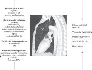 Figure summarizing the pathophysiological mechanisms involved and their effects on the left ventricle in COPD. CF: cardiac frequency; FEV1: forced expiratory volume in the first second; IC/TLC: ratio between the inspiratory capacity and total lung capacity; PH: pulmonary hypertension; RV: right ventricle; RVol: residual volume.