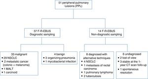 Flow-chart diagram of the diagnostic procedures performed and the final diagnoses of PPL. Abbreviations: F-R-EBUS, fluoroscopic-guided radial probe endobronchial ultrasound; MALT, mucosa-associated lymphoid tissue; NSCLC, non-small-cell lung cancers; PPL, peripheral pulmonary lesions.