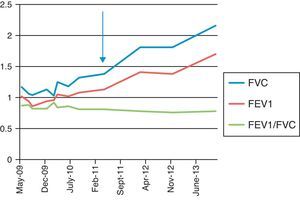 Lung function tests between May 2009 and June 2013. The arrow indicates start of treatment with rituximab. FEV1: forced expiratory volume in 1 second; FVC: forced vital capacity.