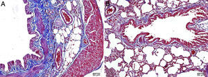 (A, B) Normal lung tissue architecture in control rats by light microscopy, Masson's trichrome stain.