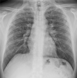 Case 2: chest X-ray (2013).