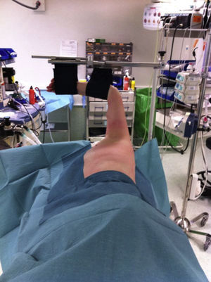 Standard positioning of patient in the operating room.