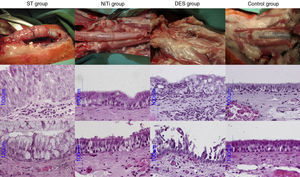 Anatomical pathology images of the tracheal responses to the assessed stents. First row, gross anatomy; second row, epithelial thickness; third row, epithelial alterations. Hematoxylin–eosin, 60×.