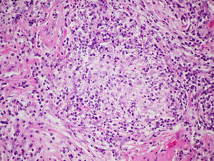 Histopathological characteristics in farmer