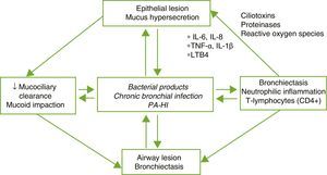 Pathogenesis of bronchiectasis. HI: Haemophilus influenzae; IL: interleukin; LTB4: leukotriene B4; PA: Pseudomonas aeruginosa; TNF: tumor necrosis factor.