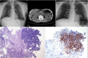 Top left, patient