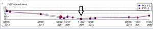 Functional progress of our patient. The arrow indicates the time of starting omalizumab.