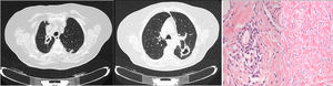 Imaging tests and histopathological study.