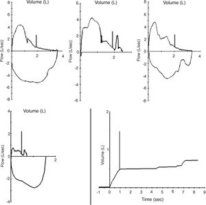 Several examples of efforts deemed as acceptable by spirometer softwares.