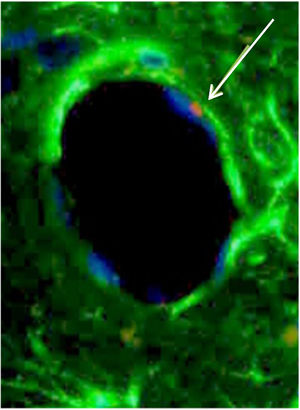 BMSC differentiated in an endothelial cell. White arrow is pointing to Sry region of CrY, which is marked in red in the FISH technique. Phenotypically, this BMSC (white arrow) is similar to an endothelial cell and is taking part of the structure of the vessel wall. The blue color is the nucleus, and green is connective tissue.
