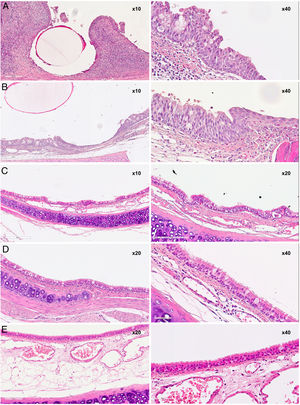 CT Pathology images. A) 30D group B) 60D group (undegraded stent). C) 60D group (degraded stent). D) 30D group E) Control group.