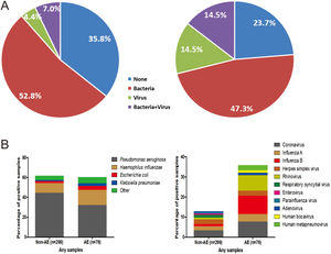 Percentage and composition of pathogens in sputum samples at AEs and stable-visits. Percentage of pathogens in sputum samples at AEs and stable visits. Bacterial and viral composition in sputum samples at AEs and stable visits. AE: acute exacerbation of bronchiectasis. Other bacteria consisted of Proteus mirabilis (n=4), Acinetobacter baumannii (n=2), Moraxella catarrhalis (n=2), Pseudomonas ozanae (n=1), Staphylococcus aureus (n=1), Haemophilus haemolyticus (n=1), Haemophilus parahaemolyticus (n=1), Streptococcus pneumoniae (n=1), Shewanella algae (n=1), Actinomyces ureae (n=1), Pasteurella multocida (n=1), Enterobacter aerogen (n=1) and Serratia marcescens (n=1). There were more patients isolated with two bacteria when clinically stable. Hence, the overall percentage of patients isolated with pathogenic bacteria appeared higher when clinically stable compared with AE onset.