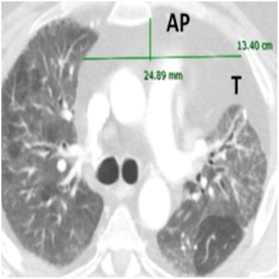 fig0030