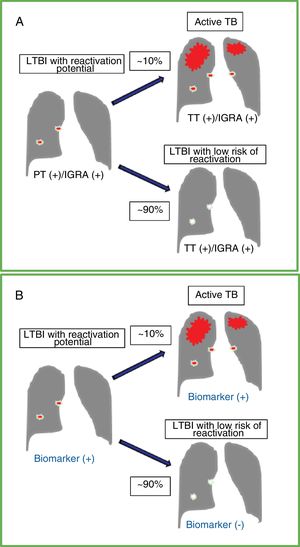 Natural course of latent tuberculous infection (LTBI), diagnostic tests and the ideal biomarker. A. Course of an untreated LTBI in an immunocompetent individual with a 5%-10% risk of developing active tuberculosis (TB) over time. The tests available for LTBI, both tuberculin testing (TT) and interferon-gamma release (IGRA) assays, usually give positive results before and after reactivation of active TB. B. Results of a test with an ideal biomarker that can differentiate latent infection with reactivation potential versus an individual with positive TT and/or IGRA results but with no significant risk of reactivation. An ideal marker would increase significantly as the disease progresses from LTBI with reactivation potential to symptomatic TB.