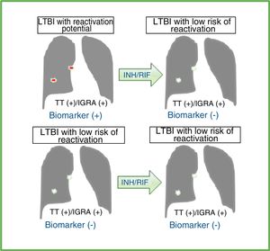 Effect of preventive treatment on diagnostic tests and ideal biomarkers in individuals with latent tuberculous infection (LTBI) with reactivation potential or low risk of reactivation. Effect of preventive treatment with isoniazid (INH) and/or rifampicin (RIF) on tuberculin test (TT) results and/or interferon-gamma release assays (IGRA) in individuals with a diagnosis of LTBI. The available diagnostic tests do not distinguish individuals with LTBI with reactivation potential from those who have already bacteriologically eradicated or effectively and permanently contained tuberculous infection (LTBI with low risk of reactivation). An ideal biomarker should be detected prior to preventive LTBI treatment and not subsequently in cases of LTBI with reactivation potential. In cases of LTBI with low risk of reactivation, the ideal marker should not be detected before or after treatment. This does not occur with TT and/or IGRA results, which are usually positive after preventive treatment. Therefore, an ideal biomarker would improve the selection of individuals who would actually benefit from LTBI treatment, thus avoiding preventive treatment in individuals who do not need it or who have a significant risk of developing side effects with these antibiotics.