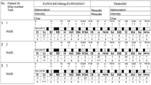 Example of intensities of anti-extractable nuclear antigen autoantibodies in bronchoalveolar lavage using immunoblot.