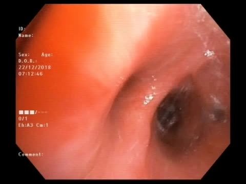 https://ars.els-cdn.com/content/image/1-s2.0-S1579212921001300-mmc1.mp4