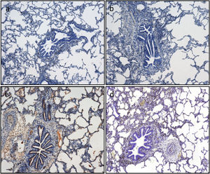 Apoptotic cell death is assessed by immunohistochemistry quantification of caspase-3. Caspase-3 positive cells are stained in brown. Representative images (a)–(d). According to the semiquantitative analysis, the percentage of stained cells in lung tissue as follows: (a) 5% corresponding to timepoint CIT0; (b) 5% corresponding to timepoint CIT1; (c) 20% corresponding to timepoint Rp30min; and (d) 15% corresponding to timepoint Rp4h.