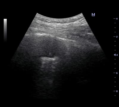 https://ars.els-cdn.com/content/image/1-s2.0-S1579212921004031-mmc1.mp4