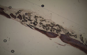 Fotomicrografia da área do defeito ósseo (Grelina – 7 semanas) (25×).