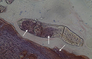 Fotomicrografia da área do defeito ósseo (Grelina – 7 semanas) (200×) (→ indicam locais de neoformação óssea).