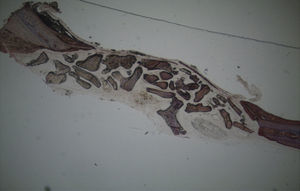 Fotomicrografia da área do defeito ósseo (Calcitonina – 5 semanas) (25×).
