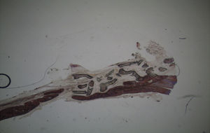 Fotomicrografia da área do defeito ósseo (Controlo – 7 semanas) (25×).