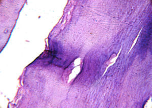 Cementoid material and fibrovascular connective tissue along the periphery (H/E 200×).