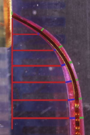 Schematic representation of a superimposed image with highlighted measurements. Inner green lines measure internal shape whereas outer blue lines measure external shape. Measurements were taken at 0mm (apex) and all following 1mm till limit of 6mm.